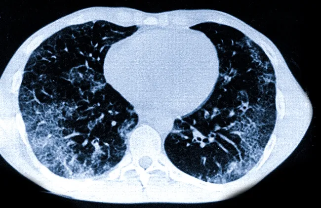 Матовое стекло