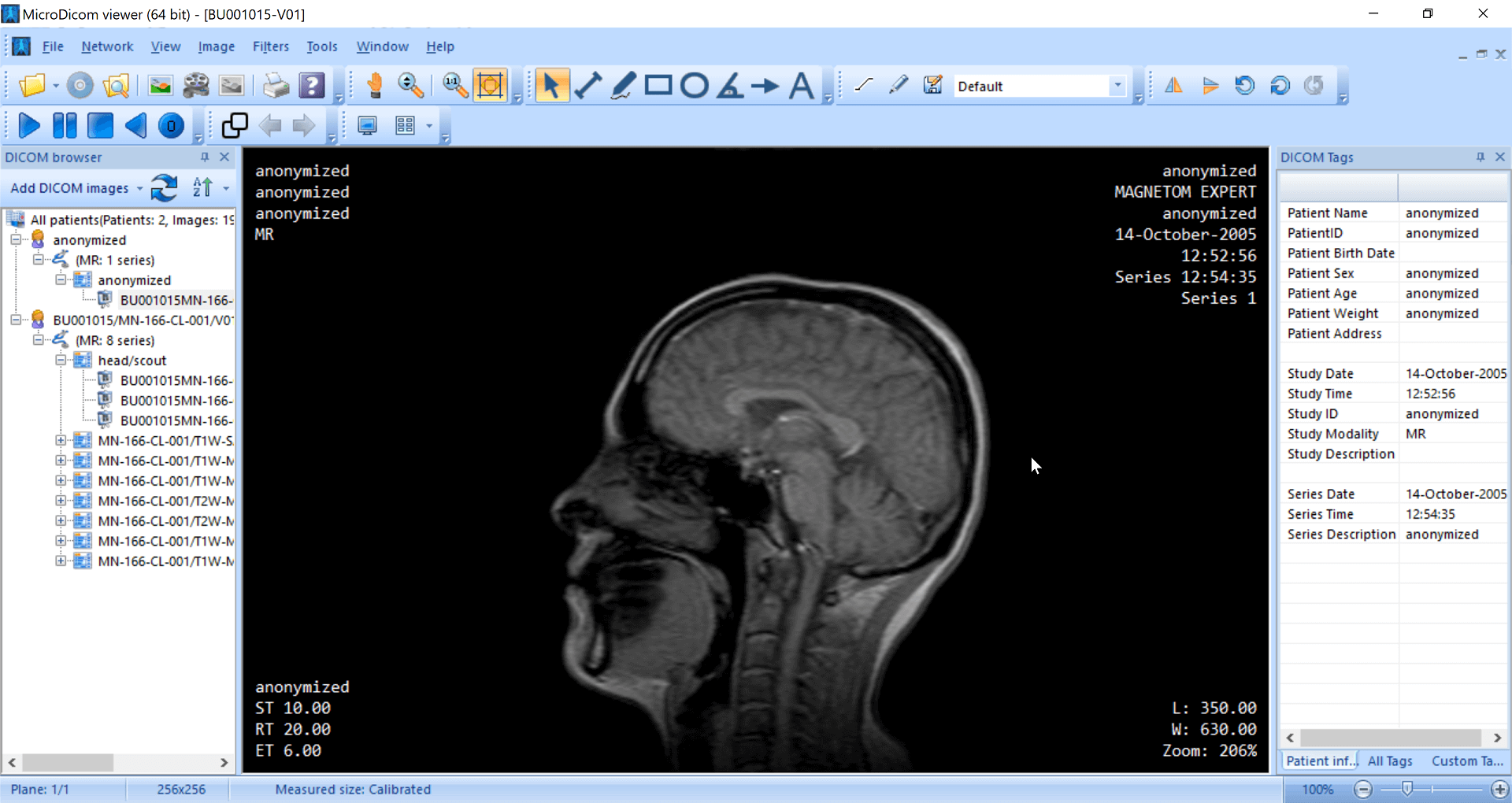 DICOM Viewer