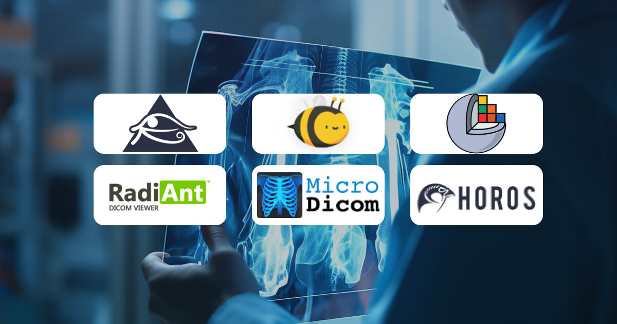 програми для перегляду КТ, МРТ - dicom файлів
